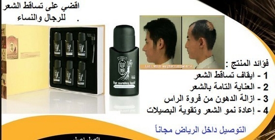 Haarverlust-Heilungshaartransplantations-Haarverlust-Behandlungs-Haarverlust in Frauen 6 * 50ml