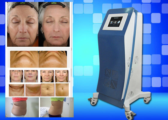 Cryo, das Ausrüstungs-Gewicht Lasers Lipo einfriert, verlieren Hauptschönheits-Maschine